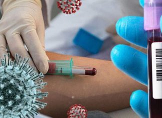 प्लाझ्मा थेरपीबाबत जनतेनी सावध रहा!